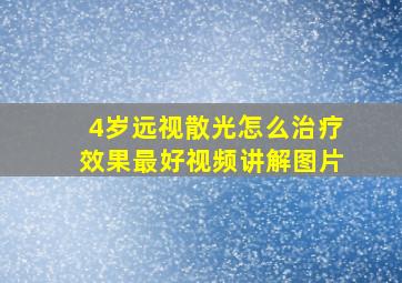 4岁远视散光怎么治疗效果最好视频讲解图片