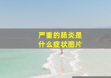 严重的肠炎是什么症状图片