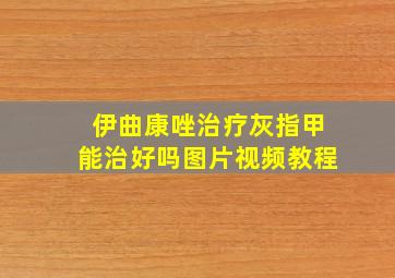 伊曲康唑治疗灰指甲能治好吗图片视频教程