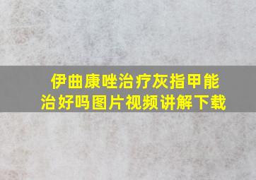 伊曲康唑治疗灰指甲能治好吗图片视频讲解下载