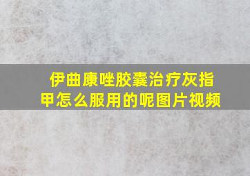 伊曲康唑胶囊治疗灰指甲怎么服用的呢图片视频