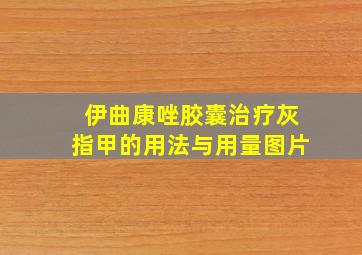 伊曲康唑胶囊治疗灰指甲的用法与用量图片