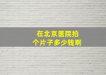 在北京医院拍个片子多少钱啊