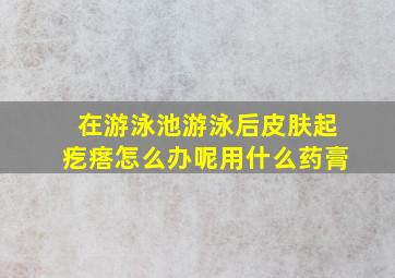 在游泳池游泳后皮肤起疙瘩怎么办呢用什么药膏