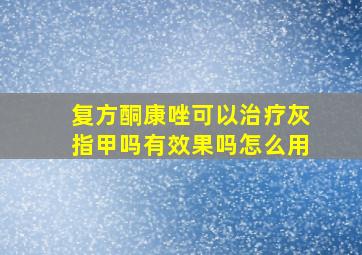 复方酮康唑可以治疗灰指甲吗有效果吗怎么用