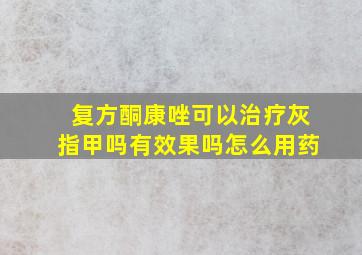 复方酮康唑可以治疗灰指甲吗有效果吗怎么用药