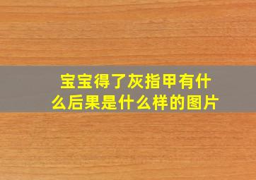 宝宝得了灰指甲有什么后果是什么样的图片