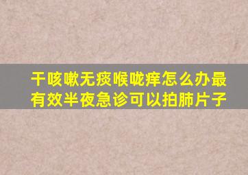 干咳嗽无痰喉咙痒怎么办最有效半夜急诊可以拍肺片子