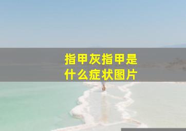 指甲灰指甲是什么症状图片