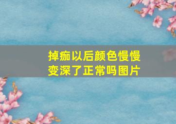 掉痂以后颜色慢慢变深了正常吗图片