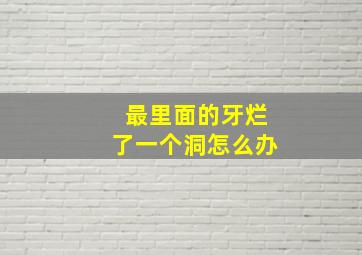 最里面的牙烂了一个洞怎么办