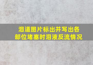 泪道图片标出并写出各部位堵塞时泪液反流情况