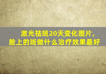 激光祛斑20天变化图片,脸上的斑做什么治疗效果最好