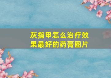 灰指甲怎么治疗效果最好的药膏图片