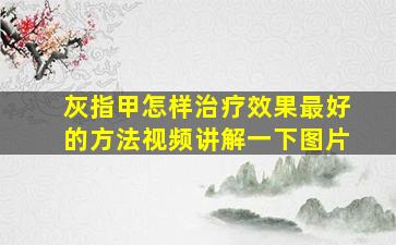 灰指甲怎样治疗效果最好的方法视频讲解一下图片