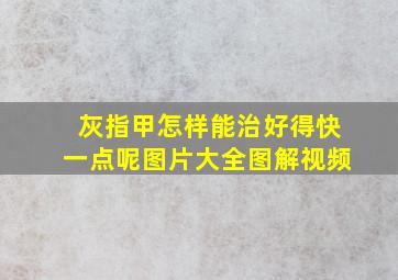 灰指甲怎样能治好得快一点呢图片大全图解视频