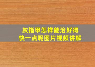 灰指甲怎样能治好得快一点呢图片视频讲解