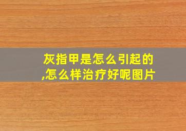 灰指甲是怎么引起的,怎么样治疗好呢图片