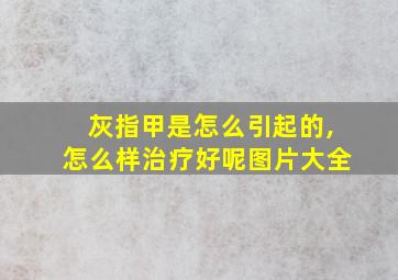 灰指甲是怎么引起的,怎么样治疗好呢图片大全