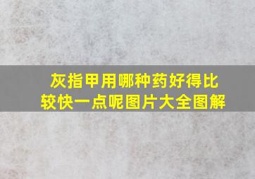 灰指甲用哪种药好得比较快一点呢图片大全图解