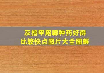 灰指甲用哪种药好得比较快点图片大全图解