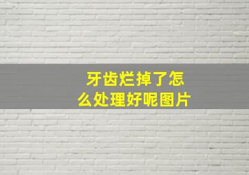 牙齿烂掉了怎么处理好呢图片