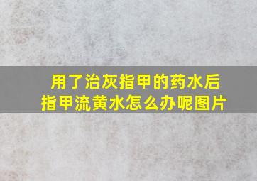 用了治灰指甲的药水后指甲流黄水怎么办呢图片