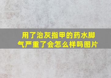 用了治灰指甲的药水脚气严重了会怎么样吗图片