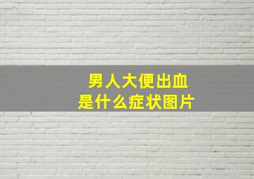 男人大便出血是什么症状图片