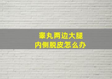 睾丸两边大腿内侧脱皮怎么办