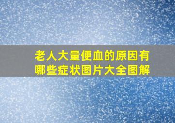 老人大量便血的原因有哪些症状图片大全图解