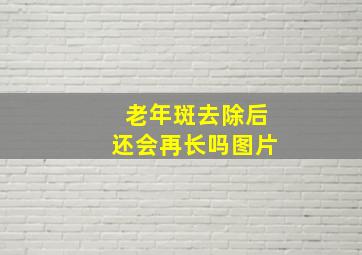 老年斑去除后还会再长吗图片