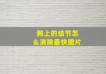 胸上的结节怎么消除最快图片