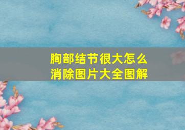 胸部结节很大怎么消除图片大全图解