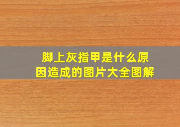 脚上灰指甲是什么原因造成的图片大全图解