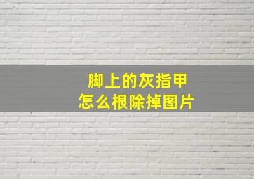 脚上的灰指甲怎么根除掉图片