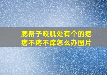 腮帮子咬肌处有个的疙瘩不疼不痒怎么办图片