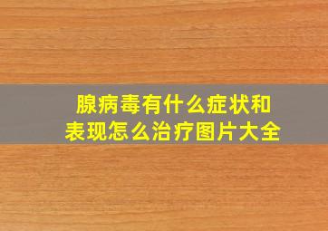 腺病毒有什么症状和表现怎么治疗图片大全