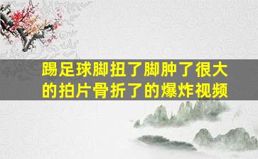 踢足球脚扭了脚肿了很大的拍片骨折了的爆炸视频