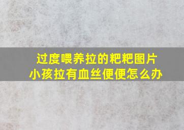 过度喂养拉的粑粑图片小孩拉有血丝便便怎么办