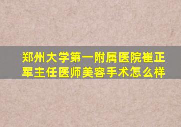 郑州大学第一附属医院崔正军主任医师美容手术怎么样