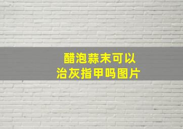 醋泡蒜末可以治灰指甲吗图片