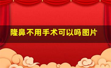 隆鼻不用手术可以吗图片