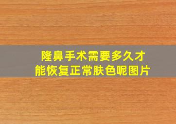 隆鼻手术需要多久才能恢复正常肤色呢图片